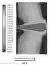 Fig. 04 - Methods using fluid stream for selective stimulation of reservoir layers