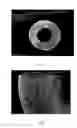 Fig. 02 - The Preparation Method Of Exo-Pressure Type Poly(Vinylidene Fluoride) Hollow Fiber Membrane Spinned Utilizing A Immersion-Coagulation Method And The Product Thereof