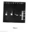 Fig. 09 - Polypeptides having an activity in the MTBE degradation path and uses thereof