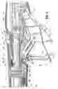 Fig. 05 - Surgical Stapling Device