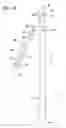 Fig. 03 - TOOL FOR SEPARATING LADDER SECTIONS