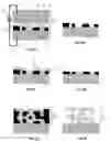 Fig. 03 - Electrochemically Fabricated Microprobes