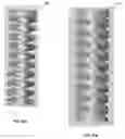 Fig. 22 - Electrochemically Fabricated Microprobes