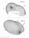 Fig. 22 - Etendue-squeezing illumination optics