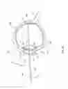 Fig. 04 - Orthovoltage radiotherapy