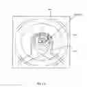 Fig. 31 - Orthovoltage radiotherapy