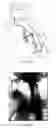 Fig. 06 - X-ray diagnostic apparatus and X-ray diagnostic system