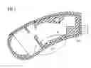 Fig. 02 - Snap-on fastening device for hearing device