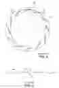 Fig. 04 - Loudspeaker suspension