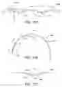 Fig. 10 - Loudspeaker suspension