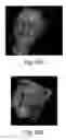 Fig. 57 - Methods and apparatus for 3D surface imaging using active wave-front sampling