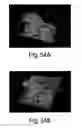 Fig. 60 - Methods and apparatus for 3D surface imaging using active wave-front sampling