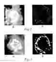 Fig. 03 - Method and Arrangement Relating to X-Ray Imaging