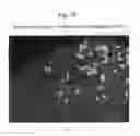 Fig. 13 - Quantitative, multispectral image analysis of tissue specimens stained with quantum dots