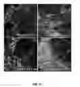 Fig. 08 - Use of endogenous fluorescence to identify invading metastatic breast tumor cells