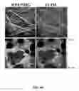 Fig. 10 - Use of endogenous fluorescence to identify invading metastatic breast tumor cells