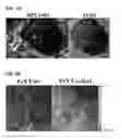 Fig. 13 - Use of endogenous fluorescence to identify invading metastatic breast tumor cells