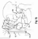 Fig. 03 - DETERMINING A THREE-DIMENSIONAL MODEL OF A RIM OF AN ANATOMICAL STRUCTURE