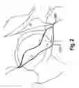 Fig. 04 - DETERMINING A THREE-DIMENSIONAL MODEL OF A RIM OF AN ANATOMICAL STRUCTURE