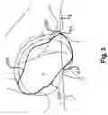 Fig. 05 - DETERMINING A THREE-DIMENSIONAL MODEL OF A RIM OF AN ANATOMICAL STRUCTURE
