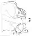 Fig. 10 - DETERMINING A THREE-DIMENSIONAL MODEL OF A RIM OF AN ANATOMICAL STRUCTURE