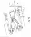 Fig. 15 - Molded communications module having integrated plastic circuit structures