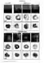 Fig. 06 - Compositions consisting essentially of TGF-β, BMP-2 FGF-4, leukemia inhibitory factor, IGF-1, IL-6 and H-α-thrombin
