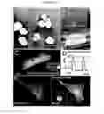 Fig. 08 - Compositions consisting essentially of TGF-β, BMP-2 FGF-4, leukemia inhibitory factor, IGF-1, IL-6 and H-α-thrombin