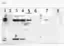 Fig. 06 - Immunoglobulin against 