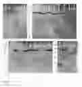 Fig. 10 - Immunoglobulin against 