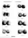 Fig. 05 - NANOSILVER-CONTAINING PRESERVATION ARTICLES, AND THE PREPARATION PROCESS AND THE USES THEREOF
