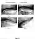 Fig. 06 - NANOSILVER-CONTAINING PRESERVATION ARTICLES, AND THE PREPARATION PROCESS AND THE USES THEREOF