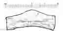 Fig. 01 - Wound dressing and method for controlling severe, life-threatening bleeding