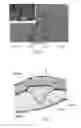 Fig. 04 - Wound dressing and method for controlling severe, life-threatening bleeding