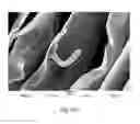 Fig. 16 - Wound dressing and method for controlling severe, life-threatening bleeding