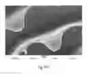 Fig. 17 - Wound dressing and method for controlling severe, life-threatening bleeding