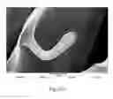 Fig. 18 - Wound dressing and method for controlling severe, life-threatening bleeding