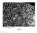 Fig. 19 - Wound dressing and method for controlling severe, life-threatening bleeding