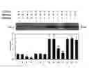 Fig. 01 - Cancer metastasis inhibitory composition