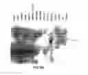 Fig. 18 - Growth Differentiation Factor-8