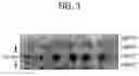 Fig. 04 - Graded glass/ceramic/glass structures for damage resistant ceramic dental and orthopedic prostheses