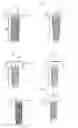 Fig. 02 - Dental implant fixture