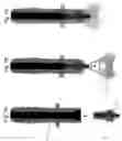 Fig. 19 - Method and apparatus for performing maxillary sinus elevation