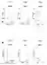 Fig. 03 - ILCS based pattern recognition of sepsis