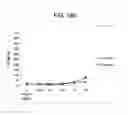 Fig. 239 - ILCS based pattern recognition of sepsis