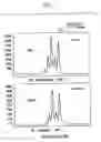 Fig. 06 - Methods for the Reduction of Stutter in Microsatellite Amplification