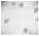 Fig. 01 - Method for culturing dendritic cells (DC) and cytokine-induced killer cells (D-CIK) and applications thereof