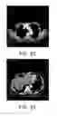 Fig. 14 - Method for culturing dendritic cells (DC) and cytokine-induced killer cells (D-CIK) and applications thereof