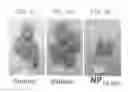 Fig. 10 - Methods and compositions for reducing activity of the atrial natriuretic peptide receptor and for treatment of diseases