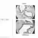 Fig. 18 - Methods and compositions for reducing activity of the atrial natriuretic peptide receptor and for treatment of diseases